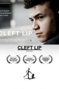   Заячья губа (2018)